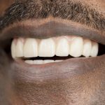 Smile Portraits for Maryland Center for Oral Surgery and Dental Implants by Kelly Heck Photography