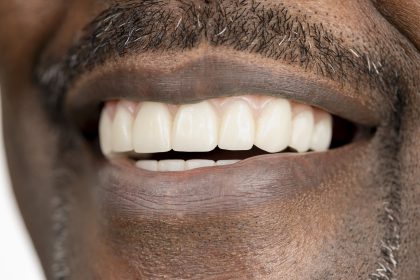 Smile Portraits for Maryland Center for Oral Surgery and Dental Implants by Kelly Heck Photography